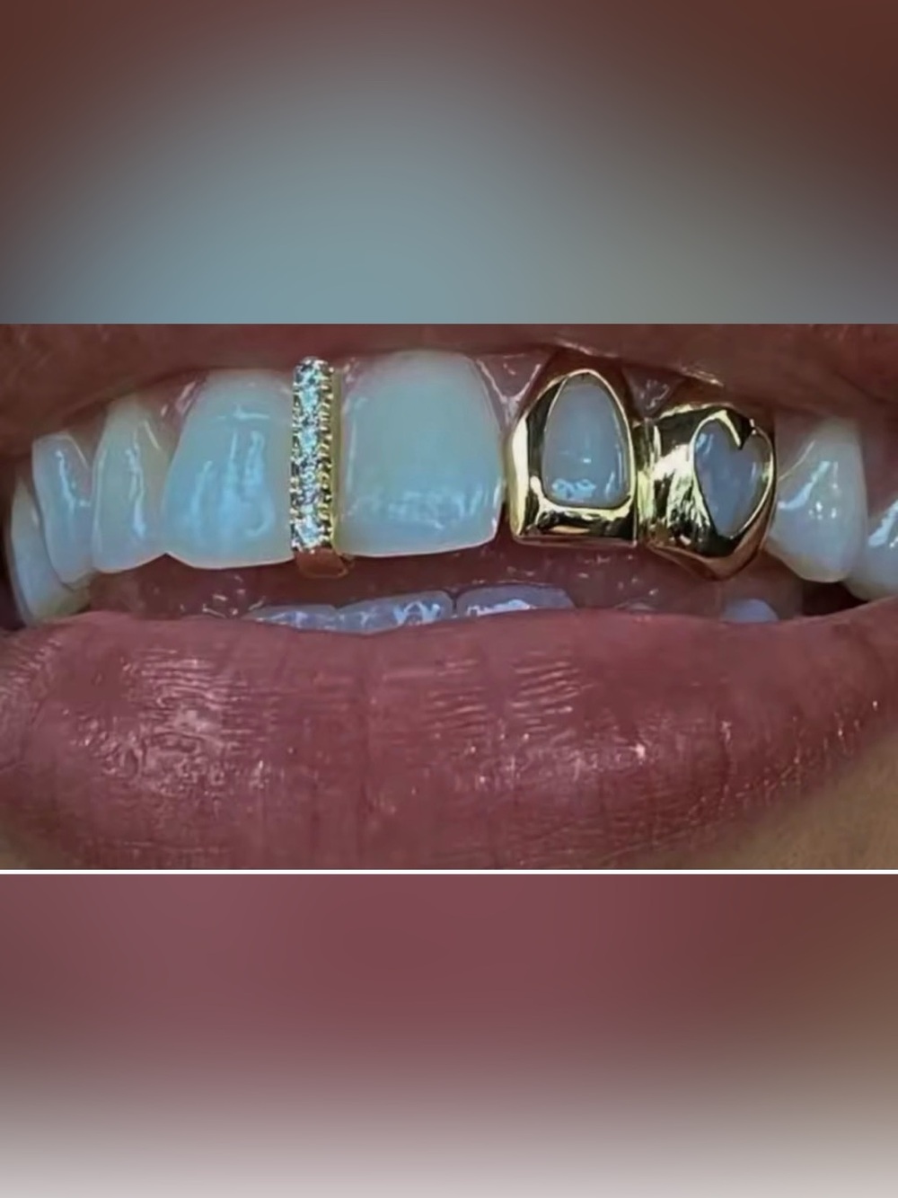 DENTAL GRILL ACCESSORY ICED
PAVE CZ SET NEW !!